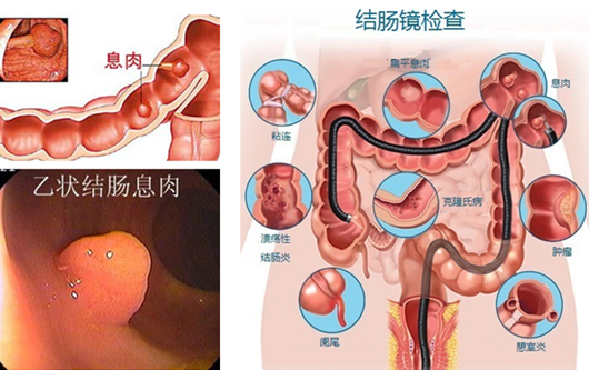 萎縮性胃炎真的“很嚇人”？看完這“七個(gè)事實(shí)”你就明白了